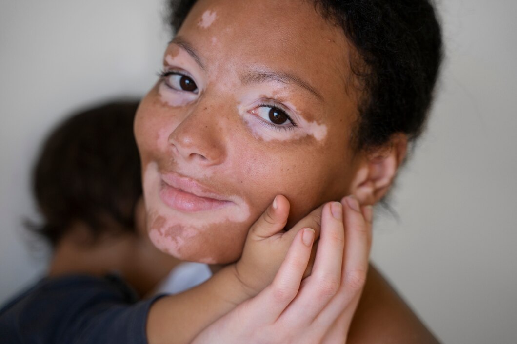 Jak skutecznie zminimalizować ciemne przebarwienia skóry bez użycia laserów?
